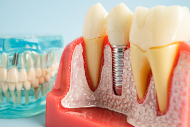 Professional Dental Services in Long Valley, NJ